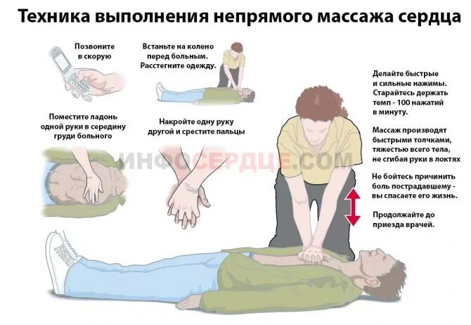 Прединсультные признаки у женщины. Алгоритм выполнения непрямого массажа сердца. Непрямой массаж сердца алгоритм действий. Техника выполнения непрямого массажа сердца алгоритм. Наружный непрямой массаж сердца.