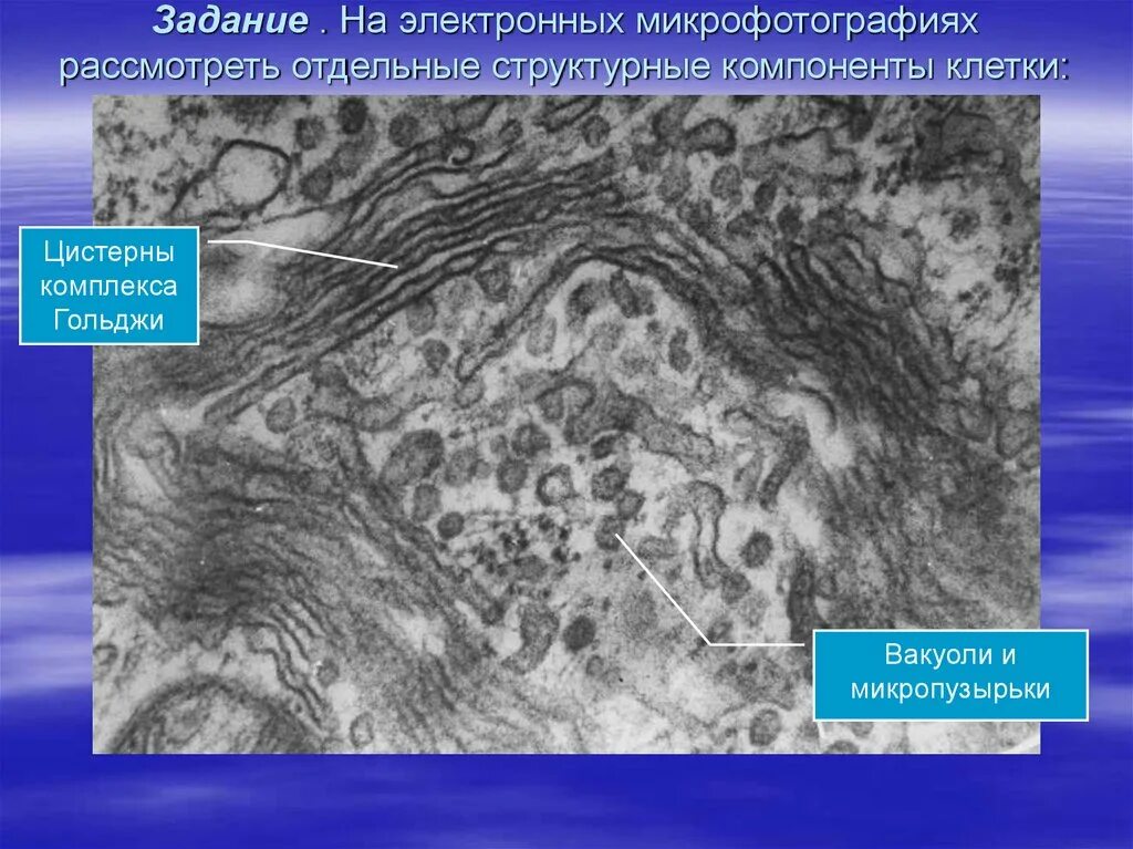 В световой микроскоп хорошо видны органоиды