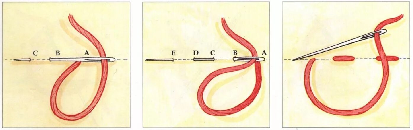 вышивальный шов стяг. несколько стежков проложенных друг за другом называются. штопальный стежок. расстояние между двумя проколами иглы. шов вперед иголку.