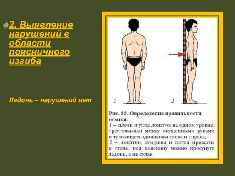 Нарушение изгиба позвоночника. Нарушение поясничного изгиба. Нарушение в области поясничного изгиба. Нарушение поясничного изгиба позвоночника. Как определить поясничный изгиб.