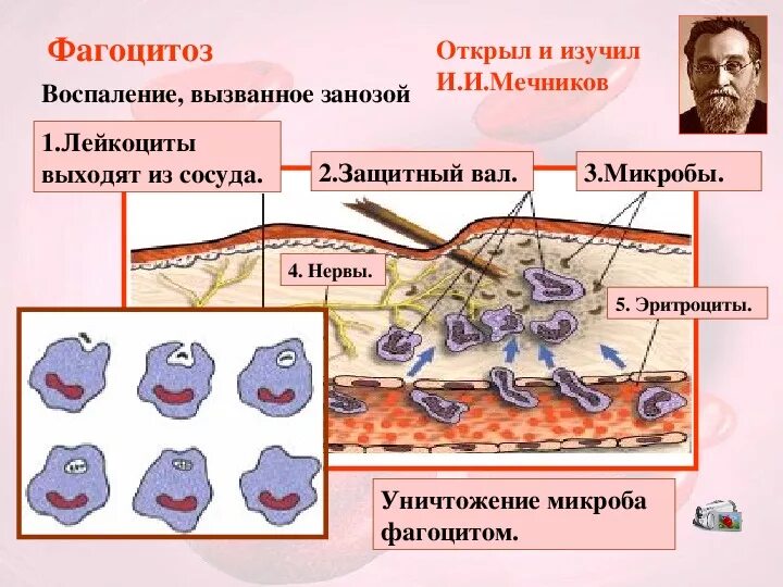 Воспаление фагоцитоз лейкоцит безразличный раздражитель микроворсинка. Фагоцитоз лейкоцитов биология 8 класс. Мечников фагоцитоз 8 класс. Микрофаги: нейтрофилы фагоцитоз. Иммунитет фагоциты.