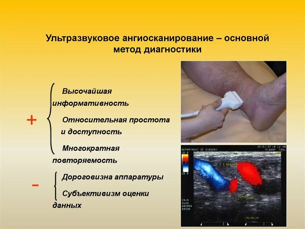 Ультразвуковые методы диагностики. Ультразвуковое ангиосканирование. Ультразвуковое дуплексное ангиосканирование. Ультразвуковое дуплексное ангиосканирование вен нижних конечностей. Ультразвуковое ангиосканирование с цветным картированием кровотока.