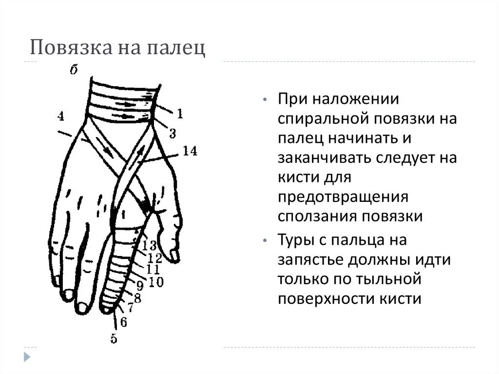 Повязка на кисть алгоритм. Повязка на один палец техника наложения. Наложение повязки на 1 палец кисти. Спиральная повязка на 1 палец показания. Технику наложения повязки на i палец правой кисти.