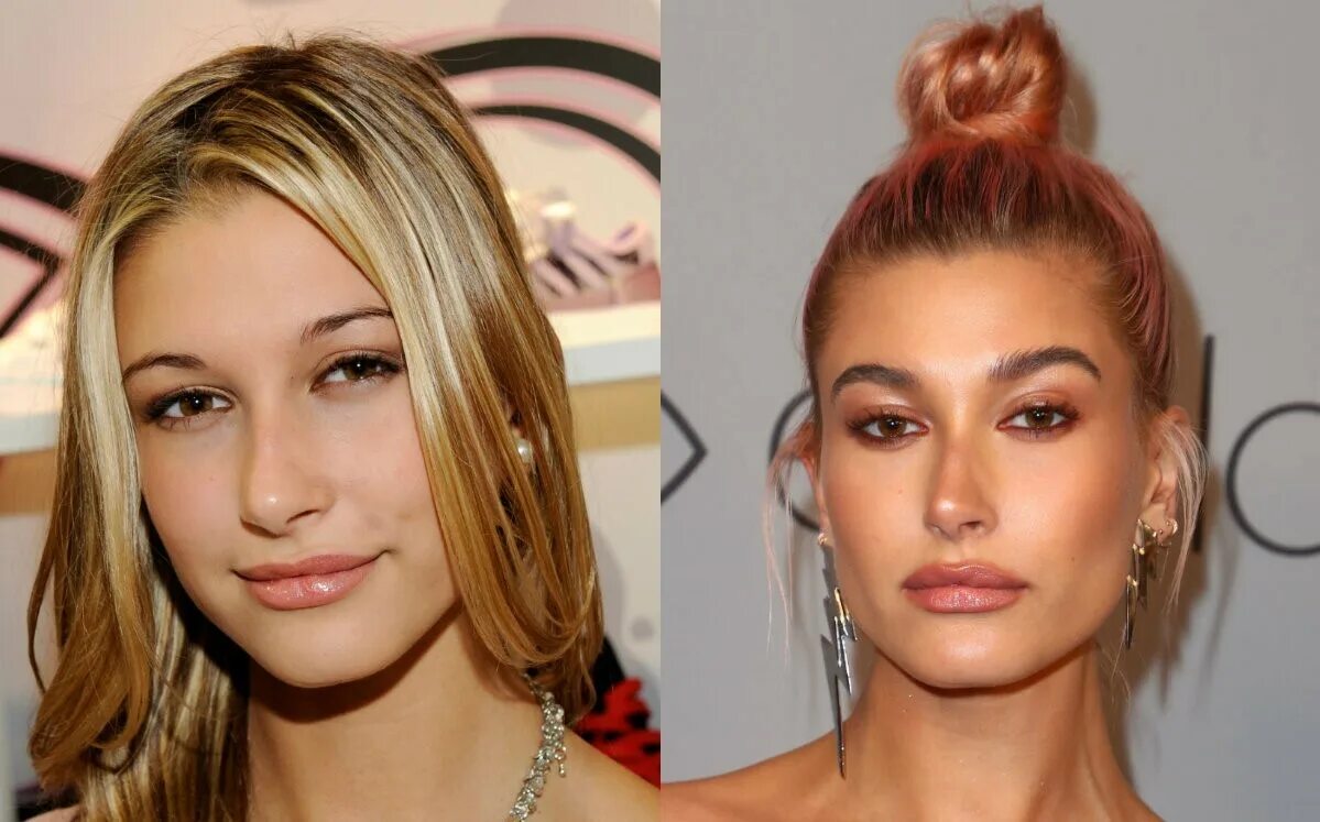 хейли болдуин допоастики. хейли бибер. хейли болдуин до пластики. хейли болдуин до пластики. хейли до и после пластики.