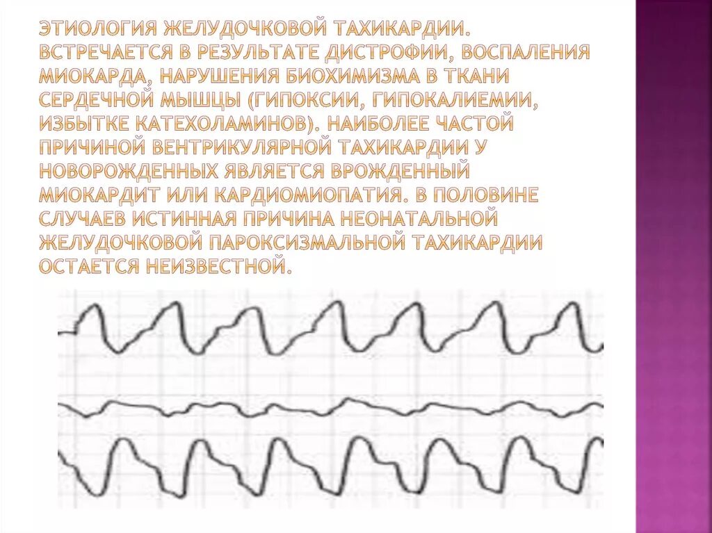 Тахикардия у ребенка 10 лет. Врожденная тахикардия. тахикардия у новорожденных. тахикардия у новорожденного ребенка. причины тахикардии у детей.