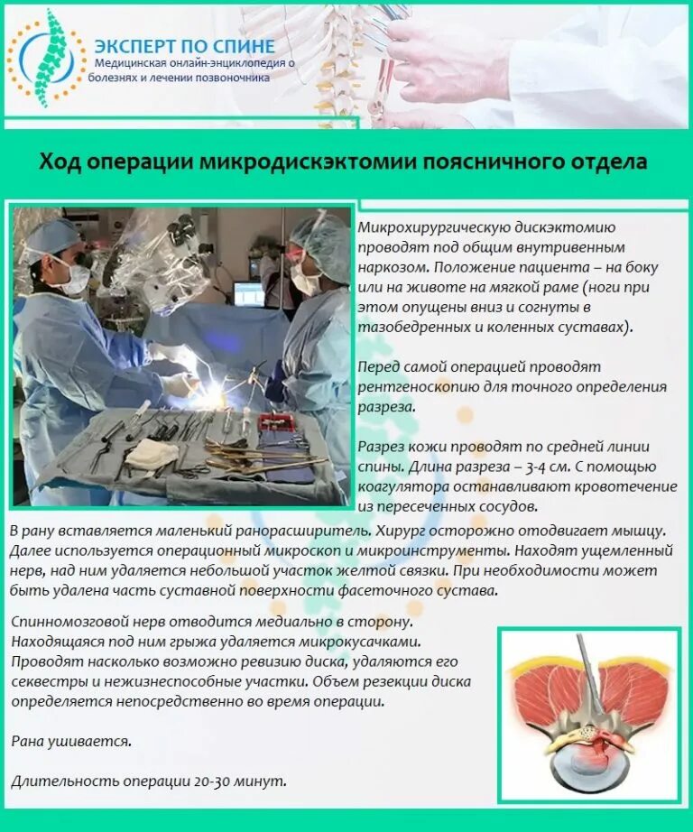 Операция грыжи позвоночника поясничного реабилитации. Микродискэктомия ход операции. микродискэктомия поясничного отдела. микродискэктомия поясничного отдела позвоночника. микрохирургическая дискэктомия поясничного отдела.