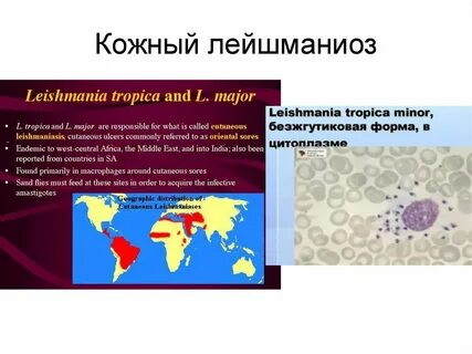 Очаг кожи