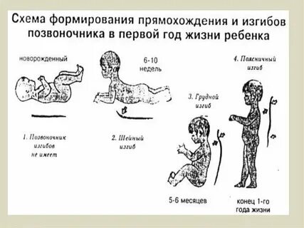 Увеличение физиологических изгибов позвоночника