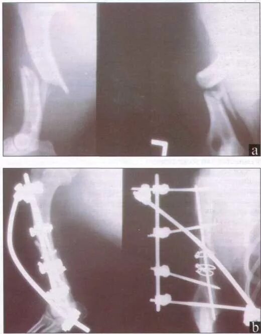 Аппарат илизарова рентген. Чрескостный остеосинтез ветеринария. Перелом со смещением собак. Остеосинтез плечевой кости у кошки. Остеосинтез задней лапы кота.