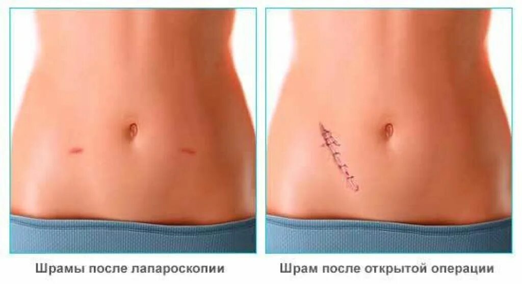 Через сколько дырок