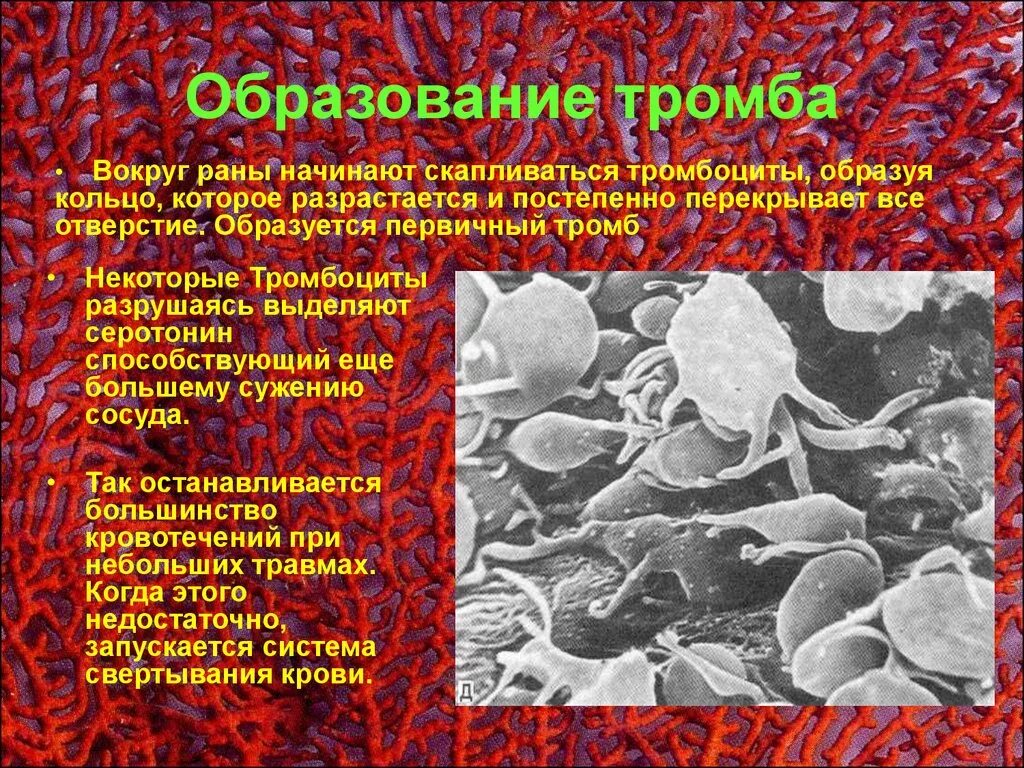 Причины и условия образования тромба. Образование тромбоцитарного тромба. Образование красного тромба в сосудах брыжейки лягушки. Тромб нити