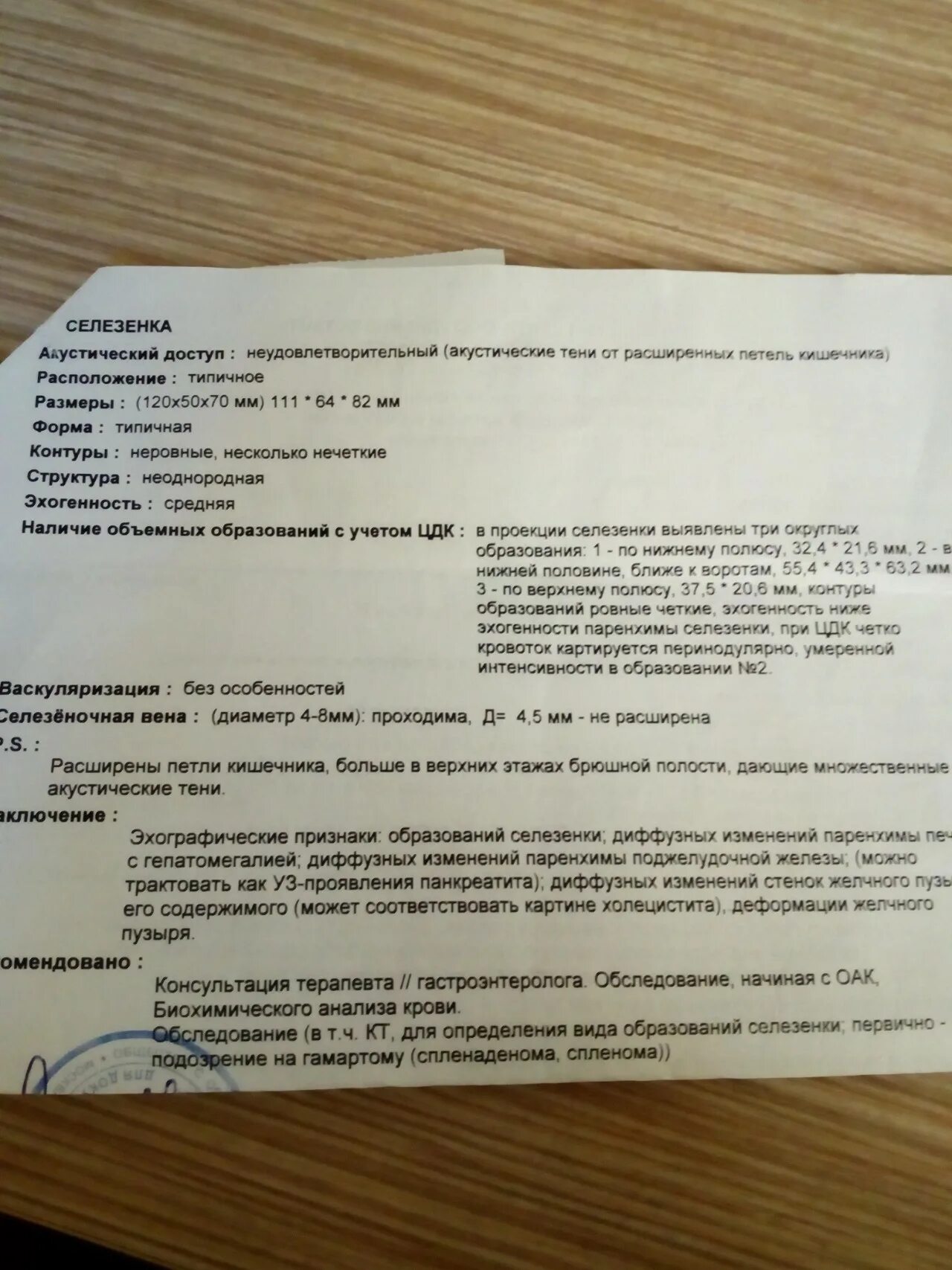 Псевдокиста поджелудочной железы на УЗИ. Наличие объёмных образований с учётом ЦДК. Объемных образований не выявлено. Что значит наличие объемных образований с учетом ЦДК.