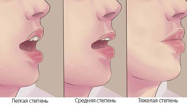 Сводит челюсть