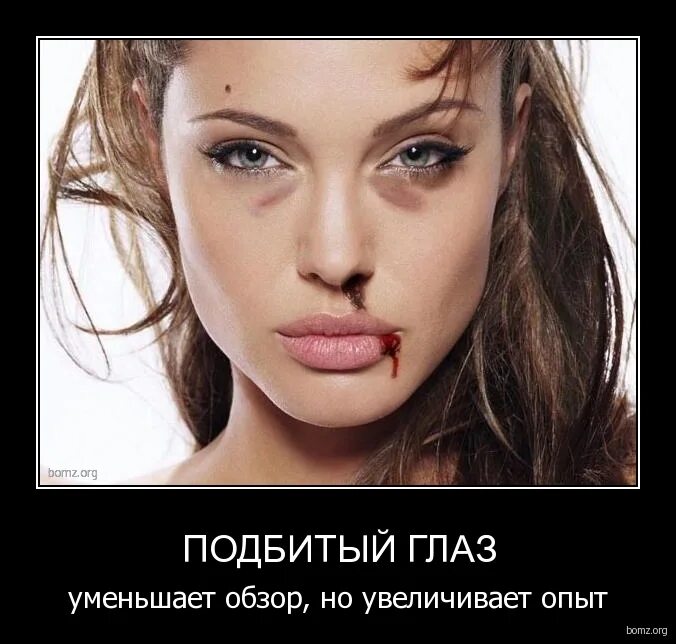 увеличивает опыт. увеличивает опыт. увеличивает опыт. подбитый глаз уменьшает зазор но увеличивает. афоризмы о судействе.