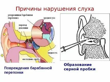 Стал плохо слышать причины
