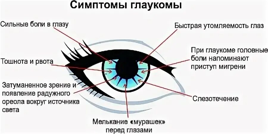 Признаки глазков. Глаукома схема глаза. Признаки глаукомы глаукома симптомы. Основные признаки глаукомы.