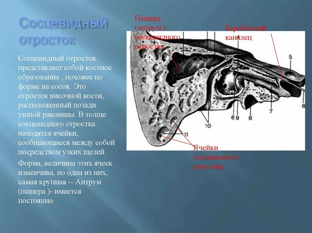 Воздухоносные ячейки сосцевидного отростка. ПНЕВМАТИЧЕСКИЙТИП строения сосцевдинго отраростка. Пневматический Тип сосцевидного отростка ячейки. Анатомия уха и сосцевидного отростка. Утолщение слизистой сосцевидного отростка