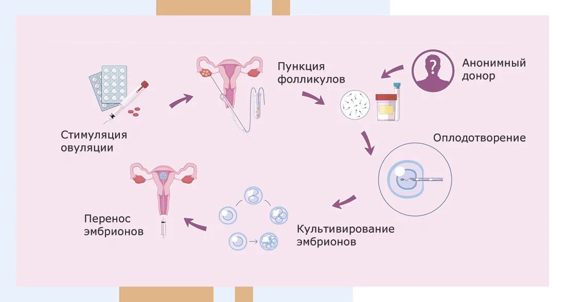 Эко от донора. Оплодотворение яйцеклетки эко. Экстракорпоральное оплодотворение схема. Схема экстракорпорального оплодотворения. Эко это искусственное оплодотворение.