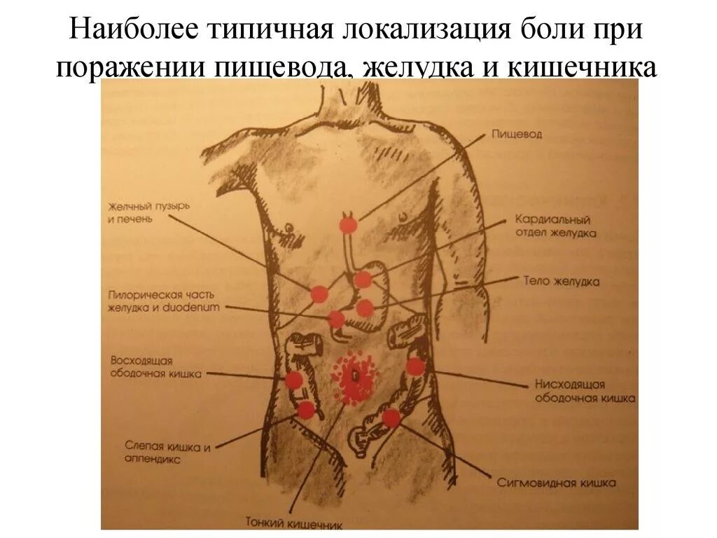 Боли в области желудка что принять. Локализация боли в животе. Локализация боли в животе в картинках. Локализация болей в левом боку. Боль в желудке локализация.