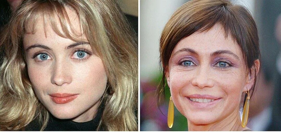 Лицо через 20 лет