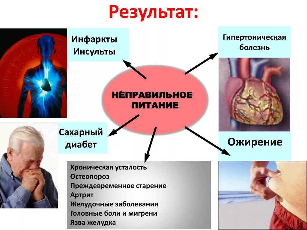 Чем отличается инфаркт от инсульта простыми. Гипертоническая болезнь. Основные симптомы гипертонии. Профилактика гипертонической болезни. Причины гипертонической болезни.