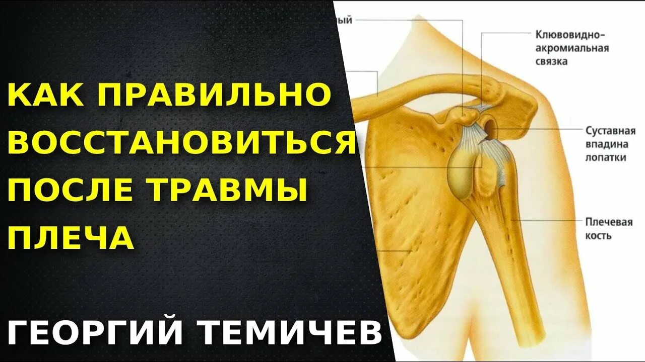 Сколько восстанавливаются плечи. Как восстановить плечо. Травма плечевого сустава в спорте. Как восстанавливать травмированное плечо?.