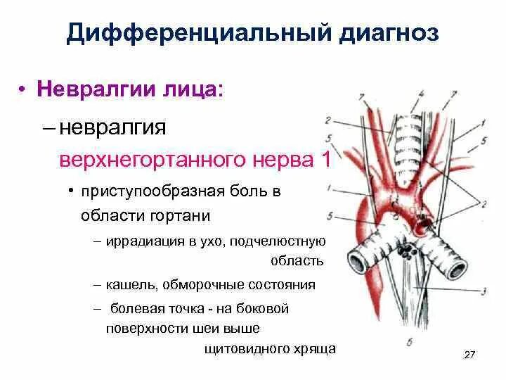 Нейропатия затылочного. Малый затылочный нерв невралгия. Невралгия верхнего гортанного нерва симптомы. Блуждающий нерв невралгия. Симптомы характерные для невралгии верхнегортанного нерва.