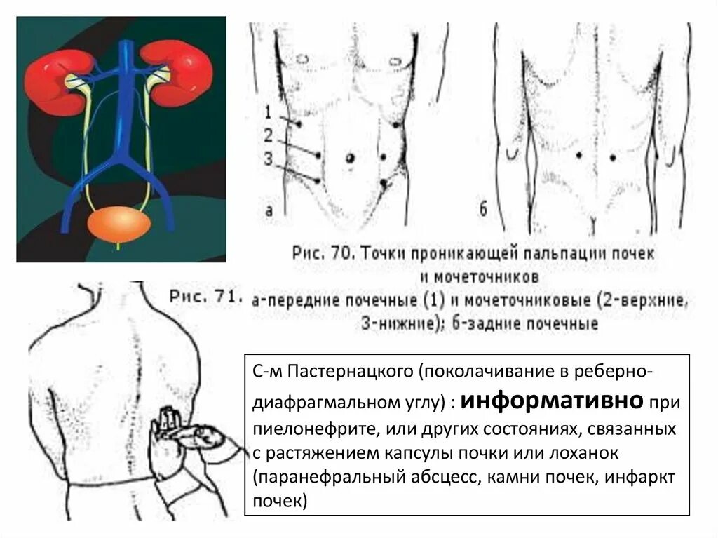 Боли в области мочеточника. Болезненные точки при заболеваниях почек и мочевыводящих путей. Точки проекции мочеточников. Проекция почек спереди. Проекция почек проекция почек спереди.