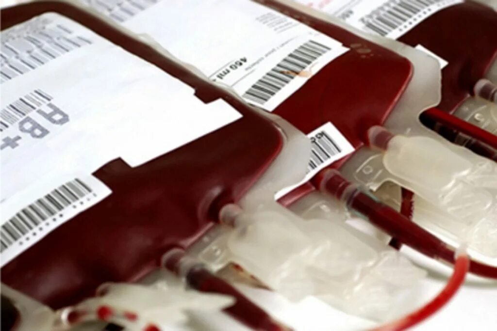 Антиген в крови донора. Переливание крови фото. Операция заменного переливания крови. Больному переливают кровь.
