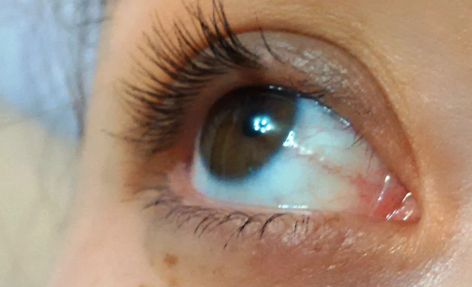 что будет если вырвать ресницы