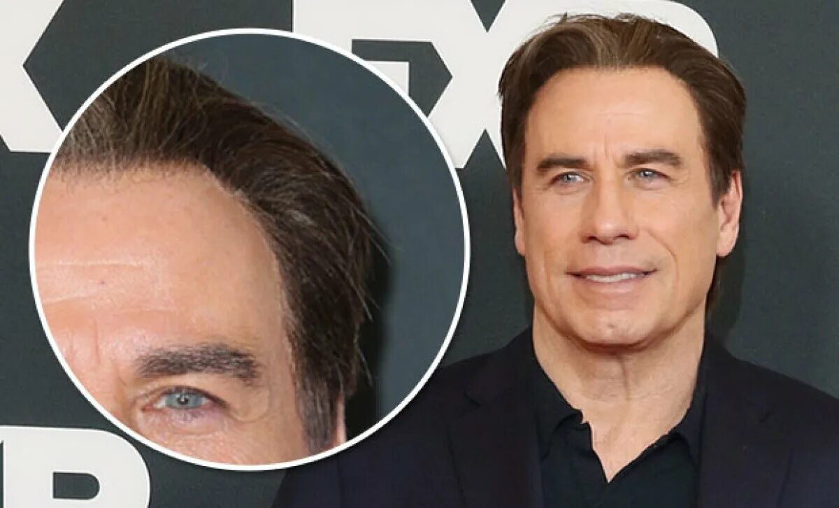 Как выглядит траволта сейчас фото 9 Celebrities You Never Knew Had Plastic Surgery And You Never Will Because We B