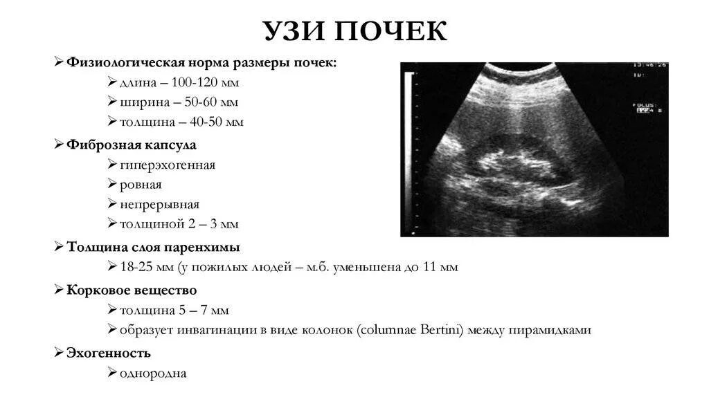 Размер почек у взрослых мужчин. Ультразвуковое исследование почек объем в норме. Параметры почек на УЗИ норма. Размер левой почки в норме по УЗИ. Показатели нормы при УЗИ почек.