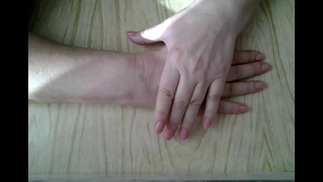 Гимнастика для рук после перелома лучезапястного сустава. ЛФК после перелома лучевой кости руки. Гимнастика при переломе лучевой кости для руки.