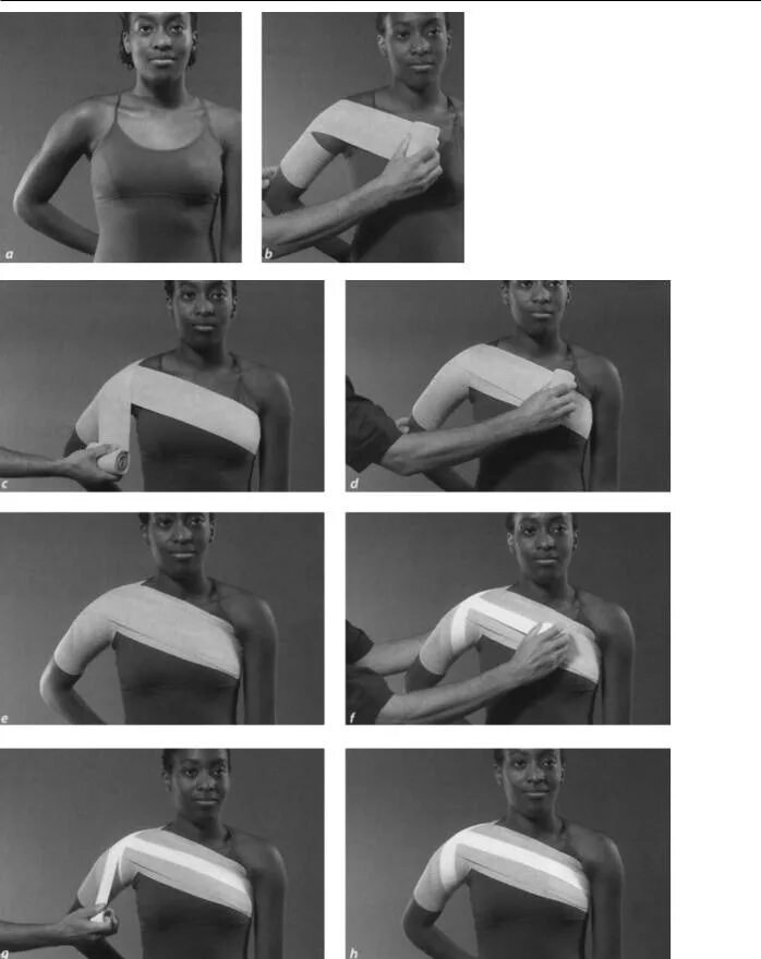 Эластичный бинт при растяжении плеча. Колосовидная при переломе ключицы. Колосовидная повязка алгоритм. Эластичное бинтование плечевого сустава. Эластичный бинт при растяжении плеча.