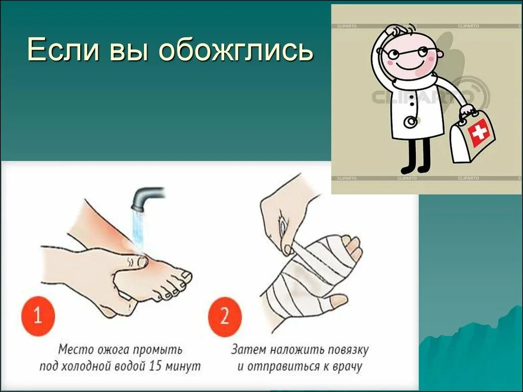 Что приложить при ожоге