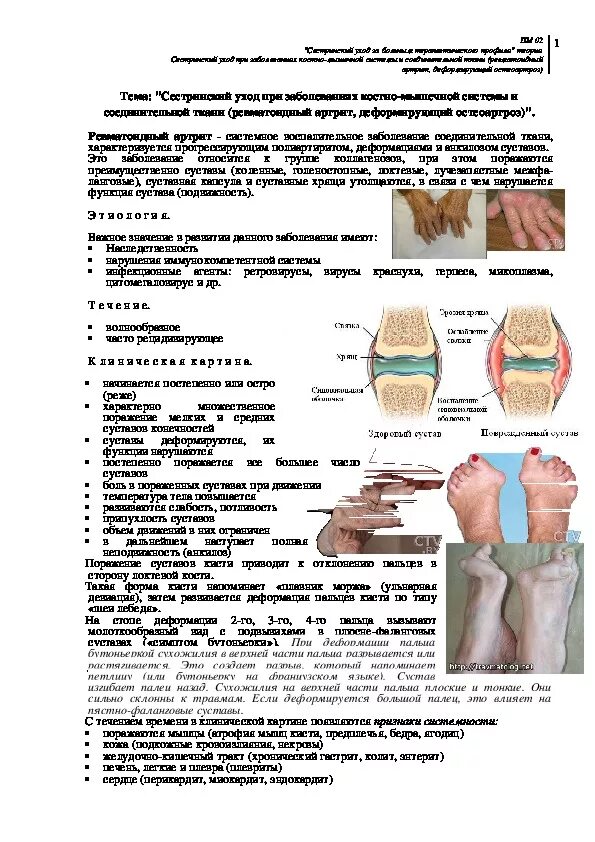 Артрита инструкция по применению цена. Буклет профилактика ревматоидного артрита. Сестринский уход при заболеваниях костно-мышечной системы. Ревматоидный артрит и деформирующий остеоартроз. Профилактика ревматоидного артрита памятка.