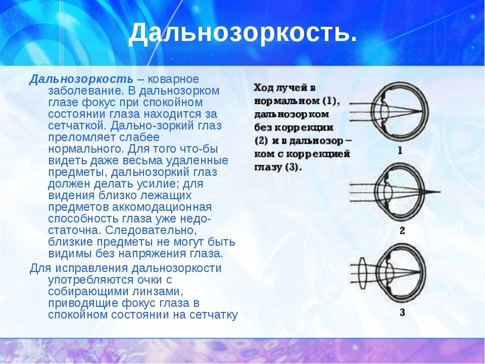 Почему у людей пожилого возраста развивается дальнозоркость. Дальнозоркость. Заболевание дальнозоркость. Глаз при дальнозоркости. Дальнозоркость развивается при.