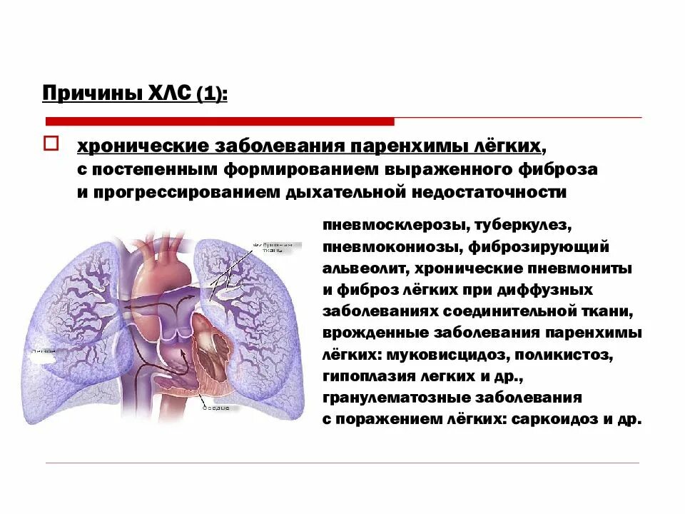 Причины ХЛС. Заболевание паренхимы легких. Идиопатическая легочная гипертензия. Хроническое легочное сердце.