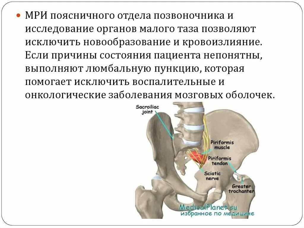 Поясничный отдел и таз. Новообразования в области поясничного отдела таза. Позвонки таза. Крестцовый отдел позвоночника с органами малого таза. Органы крестцового отдела