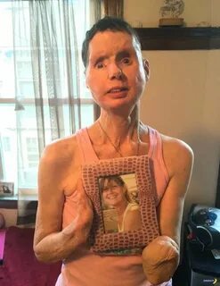 Чарла нэш