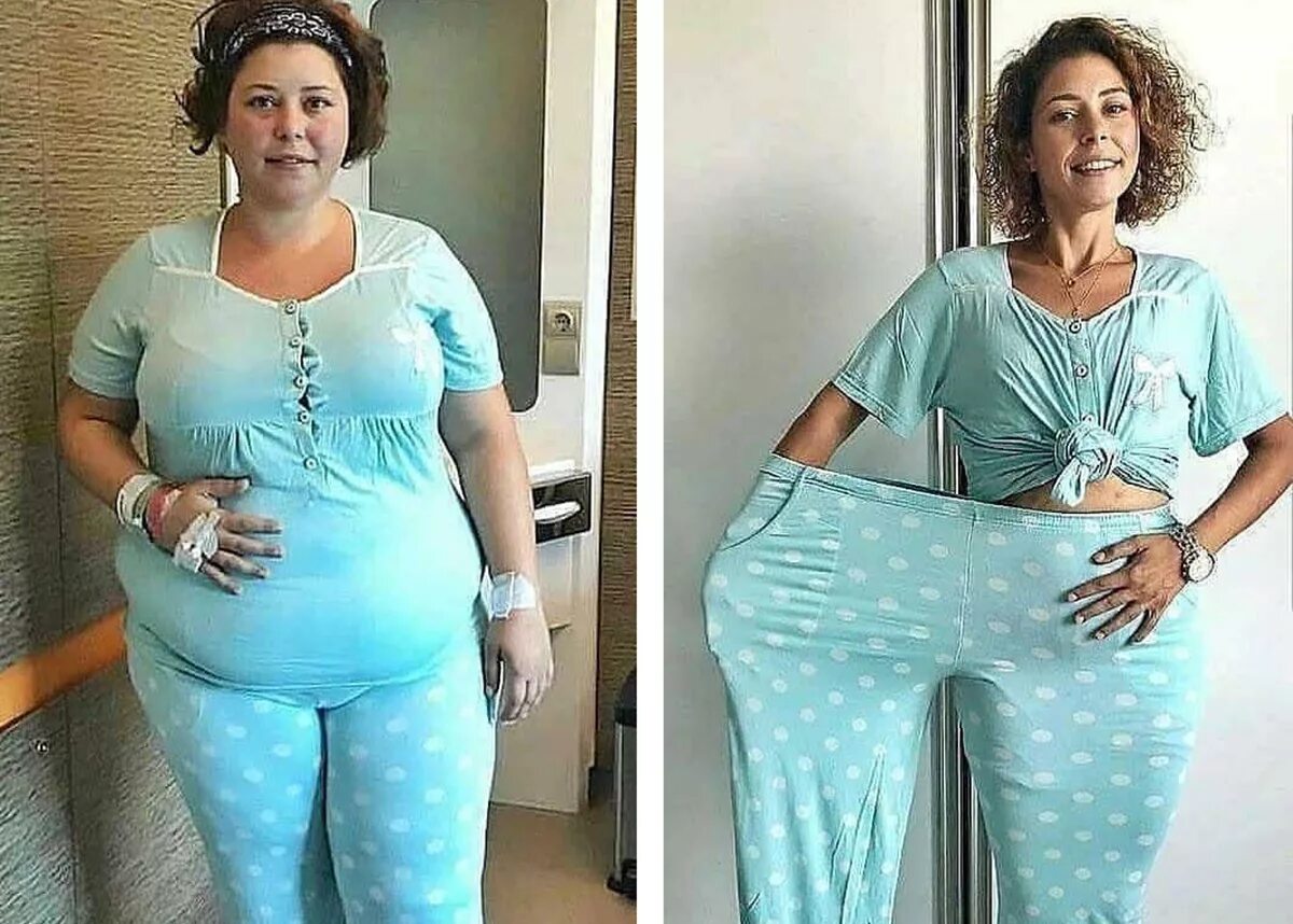 Большие девочки до и после похудения. Похудение до и после. До и после похудения девушки. Похудение до и после фото. Похудела до и после.