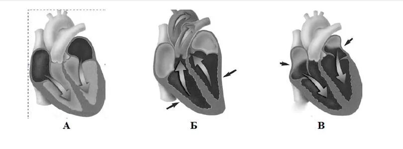 Систола предсердий и желудочков. Диастола желудочков. Сердечный цикл.фазы систолы диастолы желудочков. Систола и диастола клапаны. Состояние предсердий во время систолы предсердий