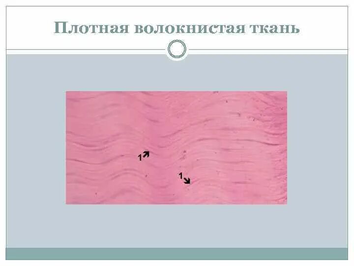 Плотная оформленная ткань. Плотная волокнистая соединительная ткань. Плотная волокнистая ткань рисунок. Классификация плотной соединительной ткани. Плотная волокнистая оформленная соединительная ткань рисунок.