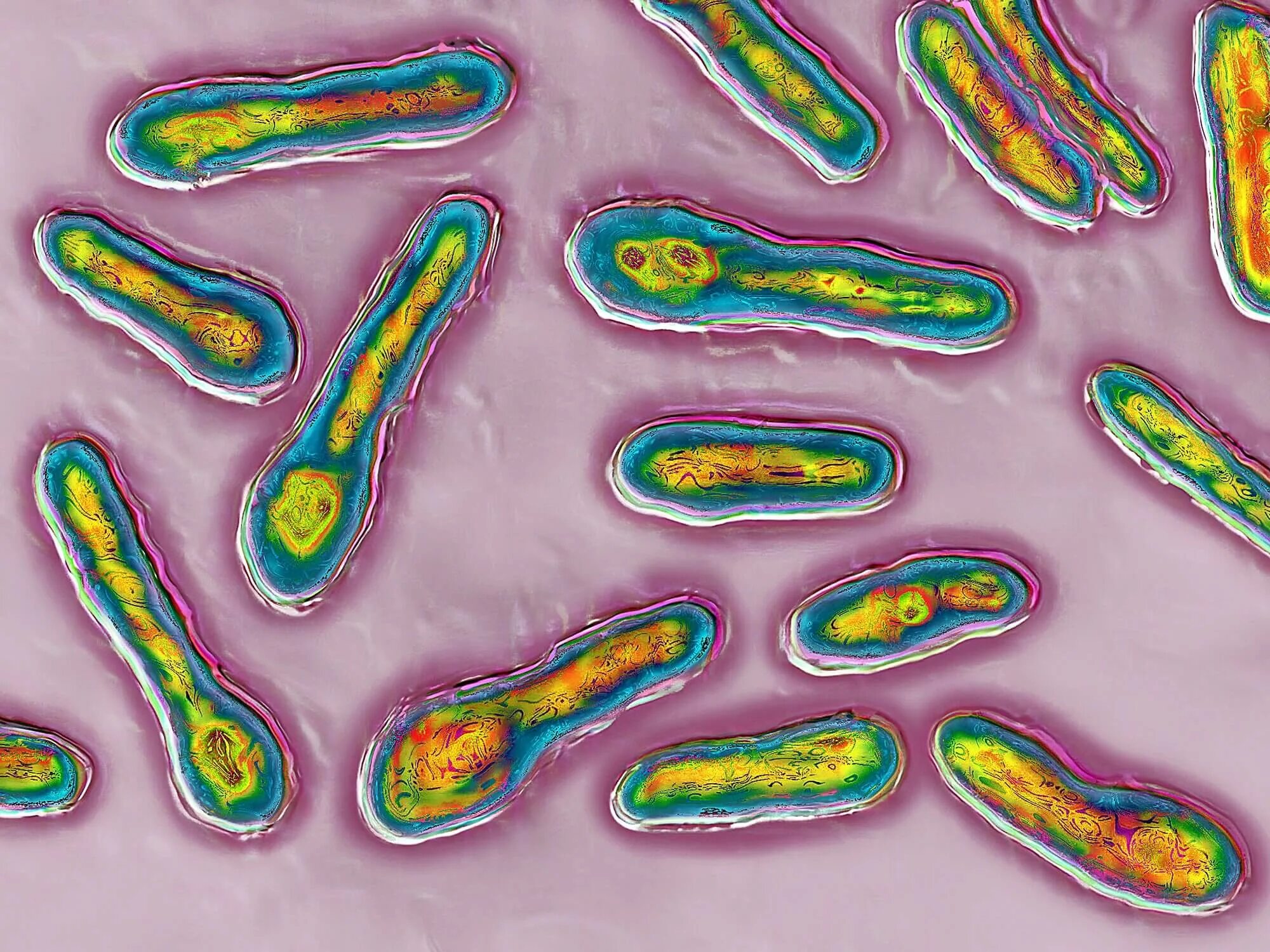 Clostridium spp. Клостридия ботулина. Клостридия ботулинум морфология.