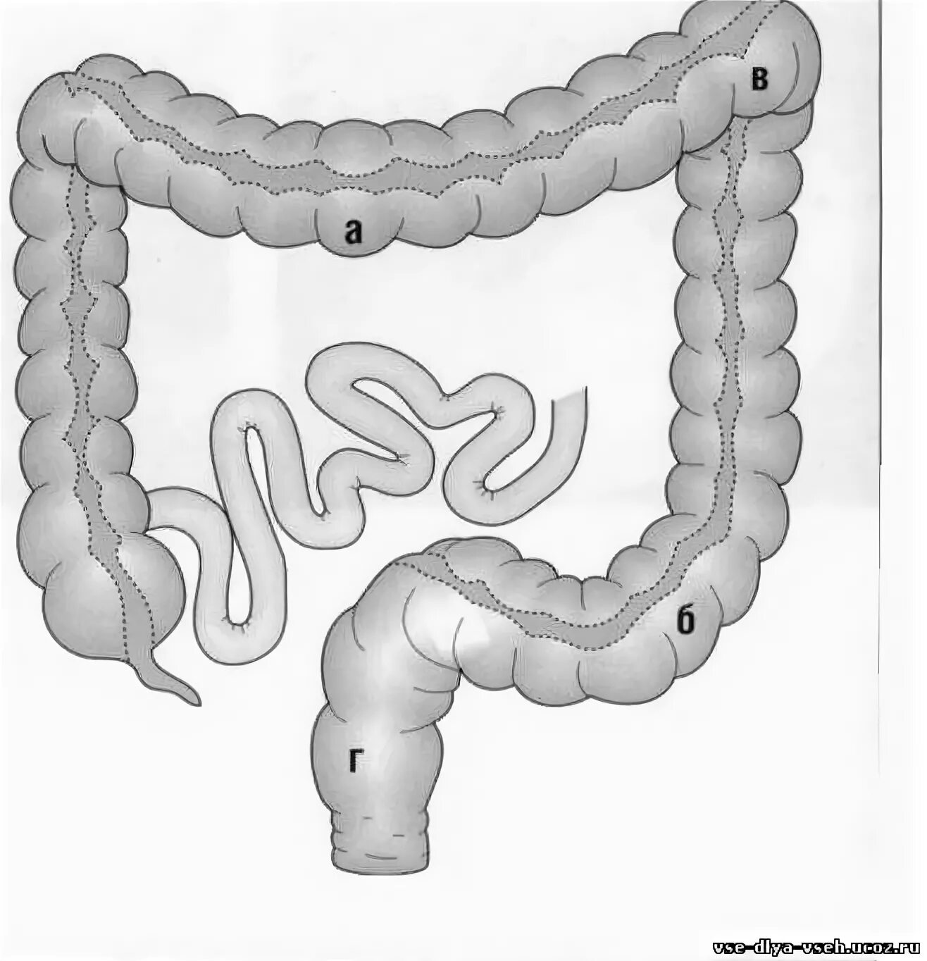 длинная брыжейка толстой кишки. без толстой кишки. толстая кишка анатомический препарат. червеобразный отросток толстой кишки. без толстой кишки.