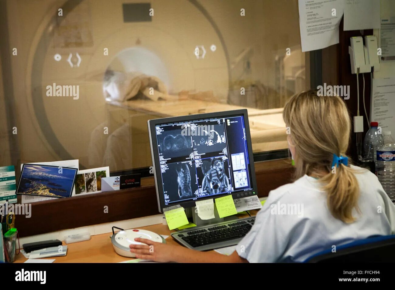 Почему мрт издает такие звуки. Аппарат мрт внутри. Кэнон 80 срезовый томограф. Почему на мрт громкие звуки. Аппарат мрт.