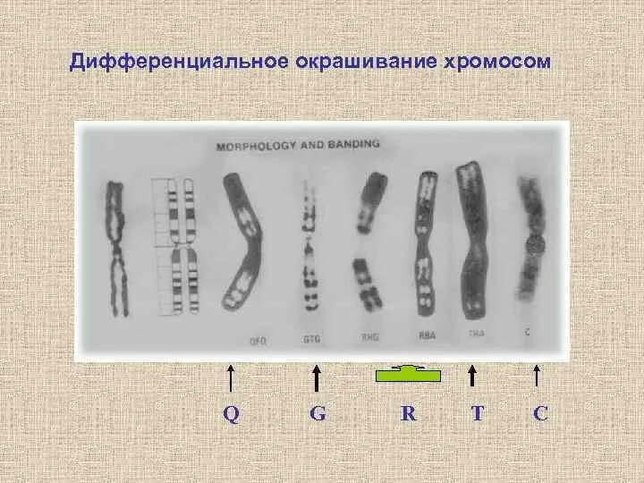 Изменение окраски хромосом