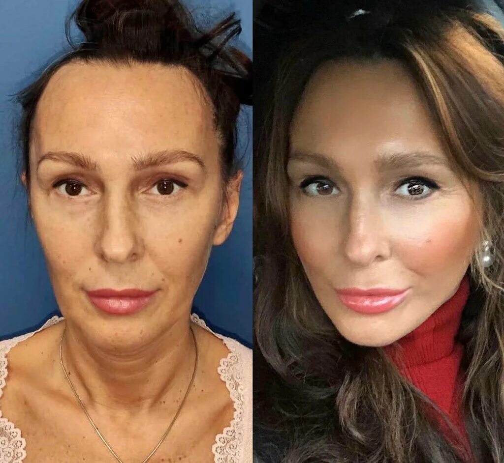 карапетян георгий эдуардович пластический хирург. карапетян пластический хирург. доктор карапетян пластический хирург. георгий карапетян пластический хирург. георгий карапетян пластический хирург.