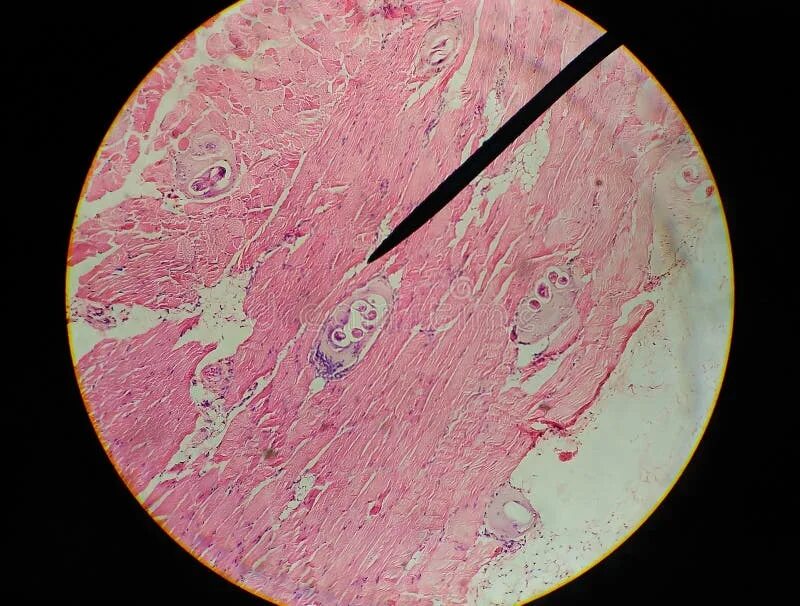 Исследования трихинеллоскопия мяса. Микроскопический метод микробиология. Трихинелла (trichinella spiralis). Ветеринарно-санитарная экспертиза. «микробиологическое исследование мяса».