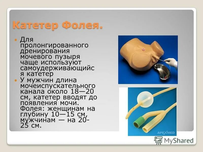 Как снять катетер фолея. Мочевыводящий катетер фолея. катетер фолея в мочевом пузыре у женщин. катетеризация мочевого пузыря фолея.